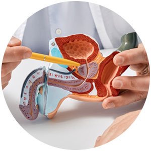 Maqueta de anatomía urológica.